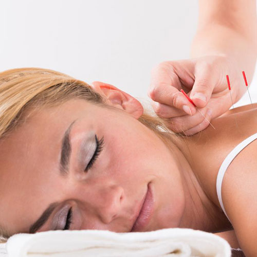Nantucket Acupuncture Treatments